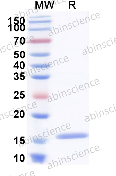 HSV1/HHV-1 ICP0 Recombinant Protein (N-His)