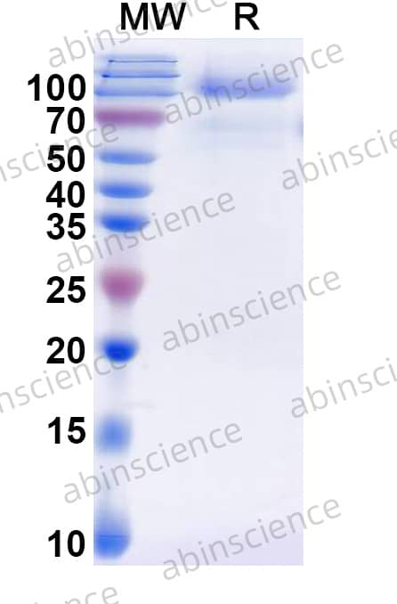 Recombinant HHV-8 glycoprotein H/gH Protein, C-His