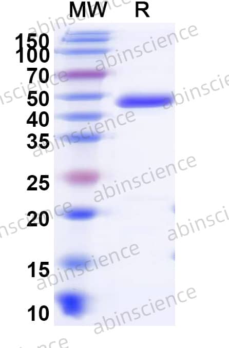 HHV-8 HELI Recombinant Protein (N-His)