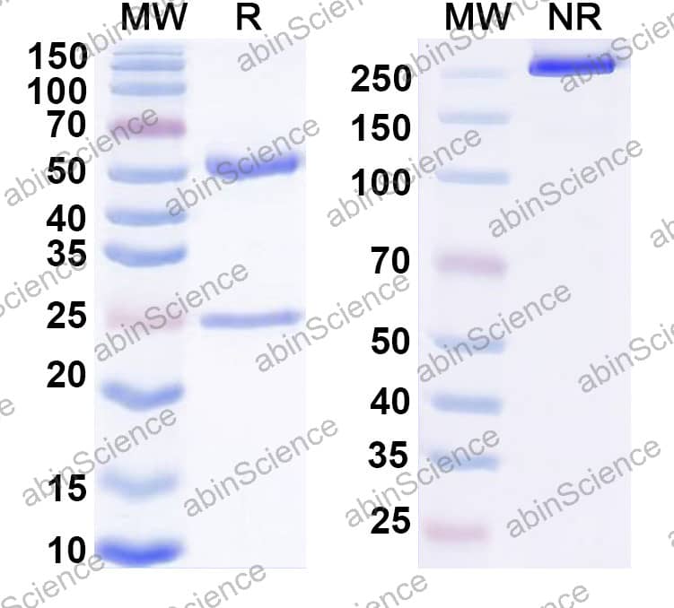 Anti-HHV-8 glycoprotein B/gB Recombinant Antibody (SAA2420)