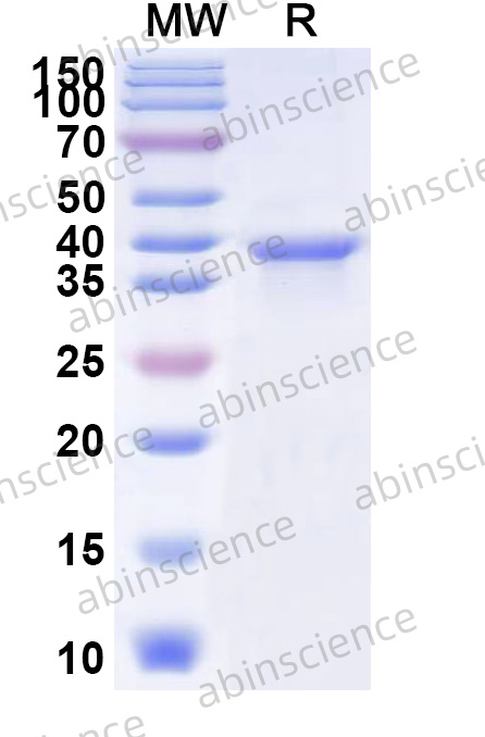 HHV-8 glycoproteinB/gB Recombinant Protein (N-His)