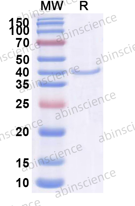 Recombinant HHV-8 glycoprotein H/gH Protein, N-His