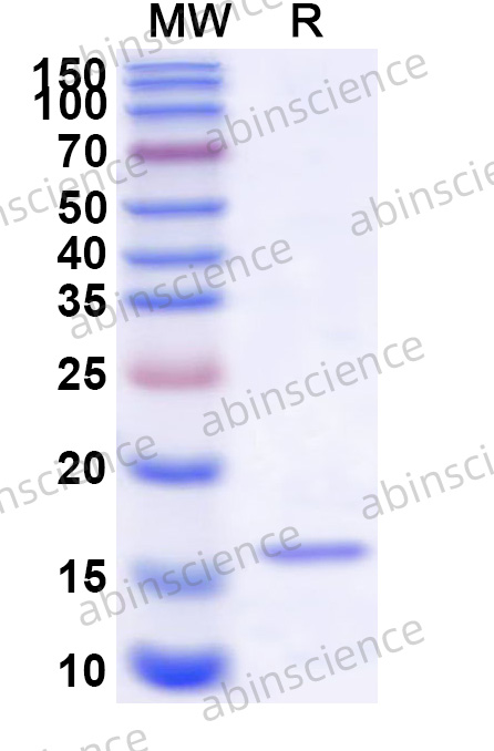 HHV-8 glycoprotein L/gL Recombinant Protein (N-His)