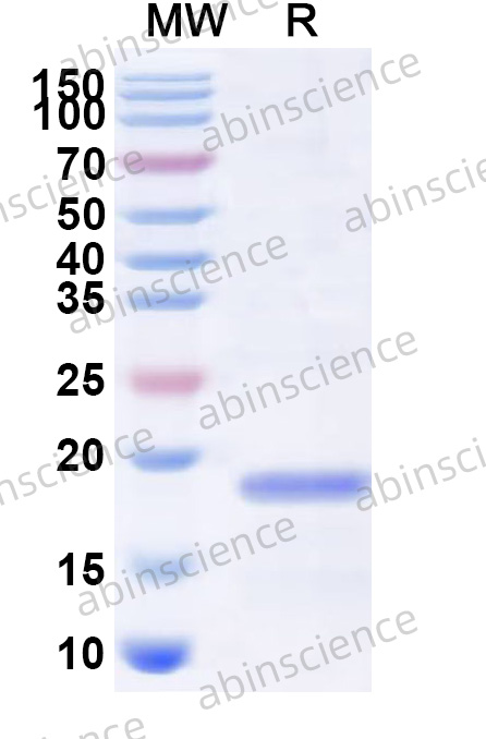 Recombinant HPeV-1 VP1 Protein, N-His