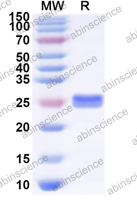 HPeV-1 Recombinant Protein 3C (N-His)
