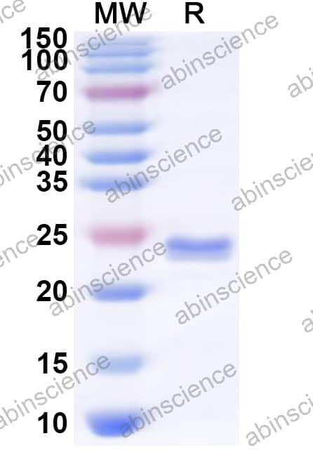 HPeV-3 VP0 Recombinant Protein (N-His)