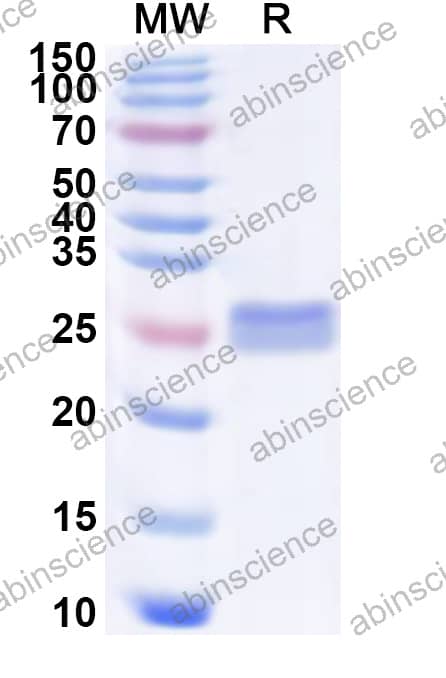 HPeV-3 VP3 Recombinant Protein (N-His)