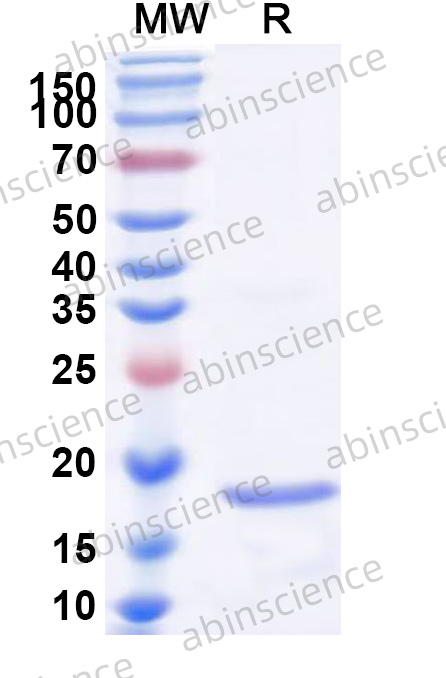 HPeV-3 VP1 Recombinant Protein (N-His)