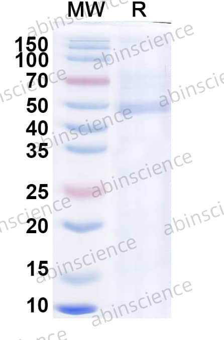 LIV Envelope E Recombinant Protein (C-His)