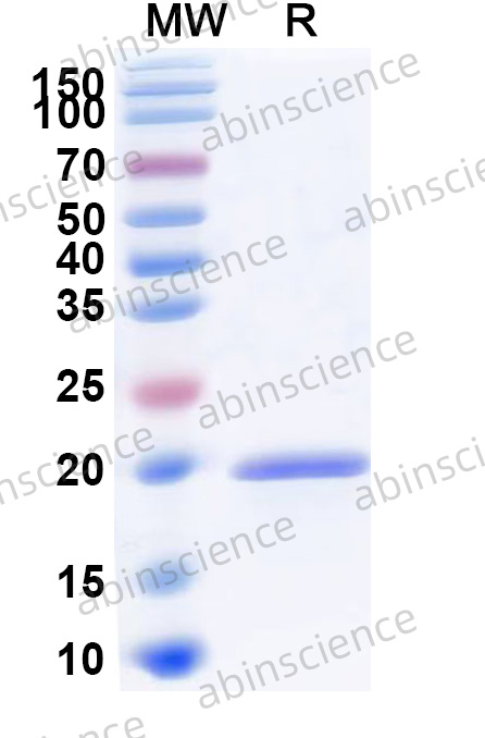 CIRV p19 Recombinant Protein (N-His)