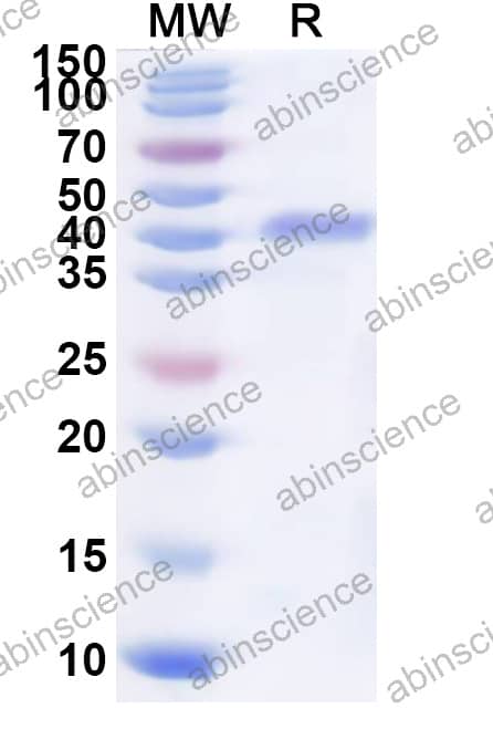 MRV-1 SigmaNS/S3 Recombinant Protein (N-His)