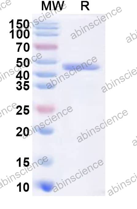 MRV-3 SigmaNS/S3 Recombinant Protein (N-His)
