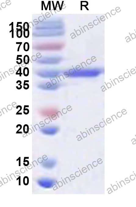MRV-3 Sigma3/S4 Recombinant Protein (N-His)