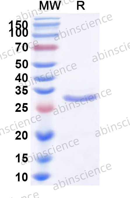 MRV-3 Sigma1/S1 Recombinant Protein (N-His)