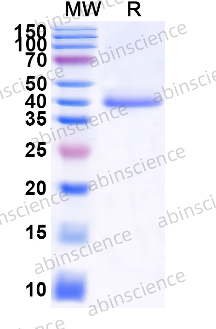 ZEBOV VP40 Recombinant Protein (N-His-SUMO)