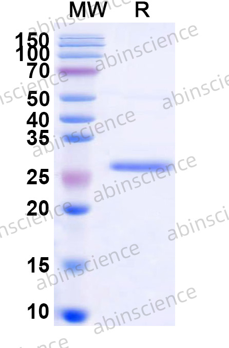ZEBOV VP24 Recombinant Protein (N-His)