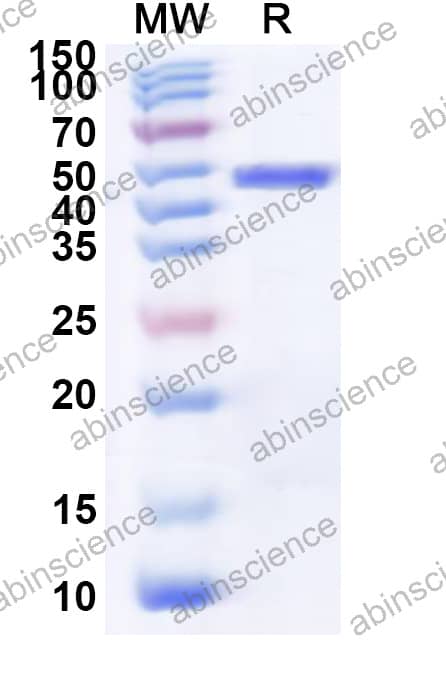 Recombinant VHSV Nucleoprotein, N-His