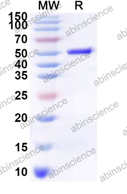 VHSV Spike glycoprotein Recombinant Protein (N-His)