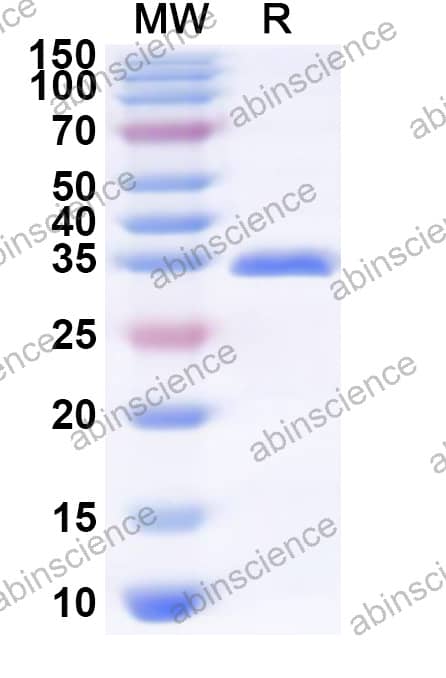 VZV/HHV-3 gI/Envelope glycoprotein I Recombinant Protein (N-GST & C-His)
