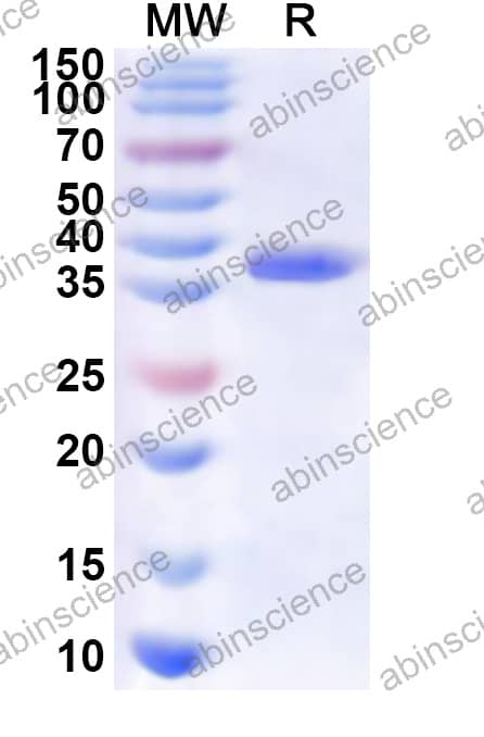 SV40 VP1 Recombinant Protein (N-His)