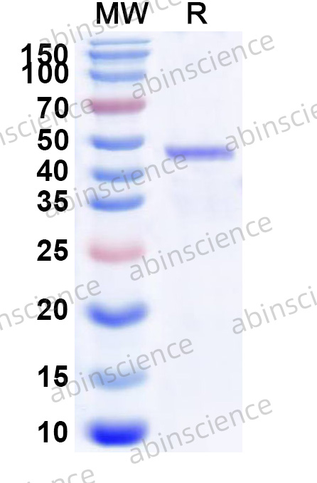 SV40 Large T Antigen Recombinant Protein (N-His)