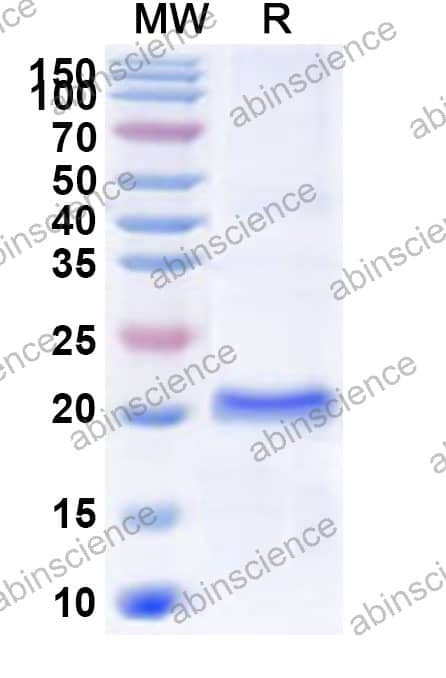 SV40 Small T Antigen Recombinant Protein (N-His)