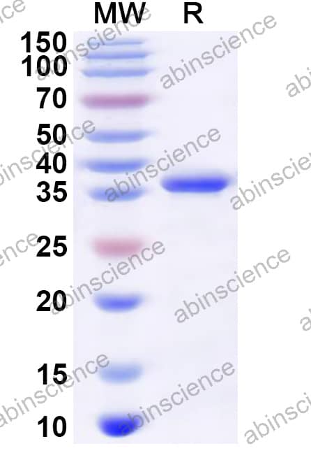 SV40 VP2 Recombinant Protein (N-His)
