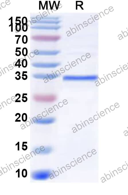 SIV VPX Recombinant Protein (N-GST & C-His)
