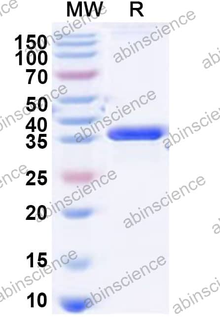 Recombinant SIV Integrase Protein, N-His