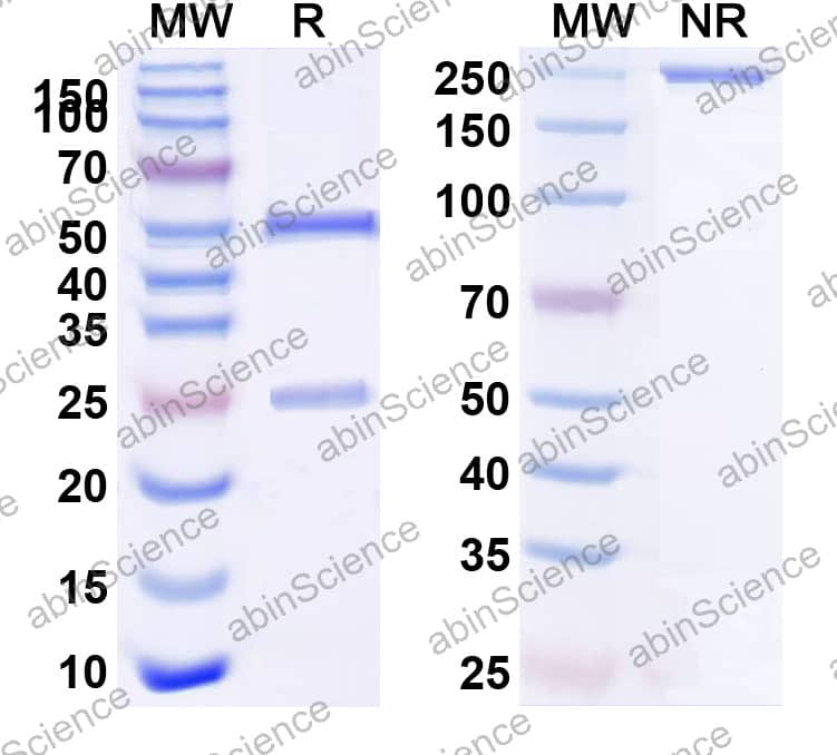Anti-HRV-14 Capsid protein VP1 Recombinant Antibody (SAA2396)