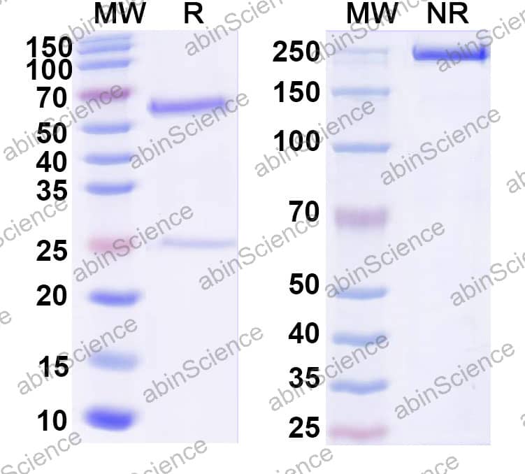 Anti-HRV-14 Capsid protein VP1 Antibody (SAA2397)