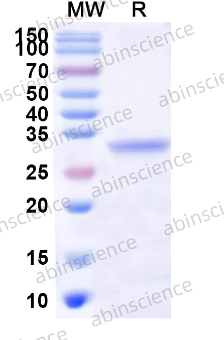 HRV-14 VP3 Recombinant Protein (N-His)