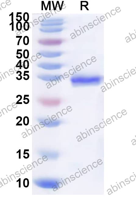 HRV-14 VP1 Recombinant Protein (N-His)