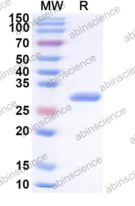 PVY Capsid Recombinant Protein (N-His)