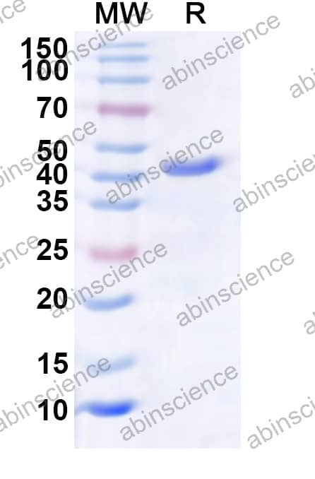 PRV-H VP6 Recombinant Protein (N-His)