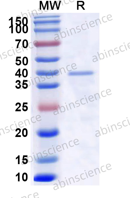 MHV-4 Spike CTD Recombinant Protein (N-His)