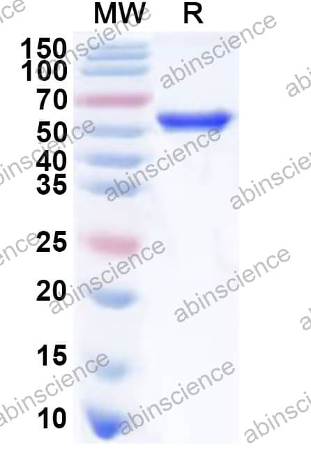 Recombinant MHV-4 Nucleocapsid Protein, N-His