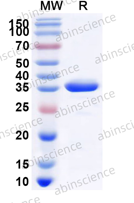 MMTV p10 Recombinant Protein (N-GST & C-His)