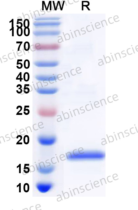 MMTV Protease Recombinant Protein (N-His)