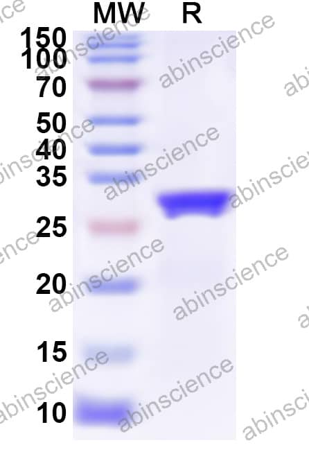 MMTV Reverse transcriptase Recombinant Protein (N-His)