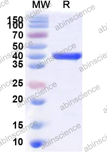 MMTV pp21 Recombinant Protein (N-GST & C-His)