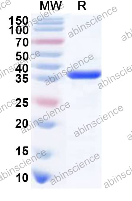MMTV Integrase Recombinant Protein (N-His)