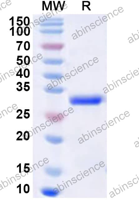 MMTV NC-dUTPase Recombinant Protein (N-His)