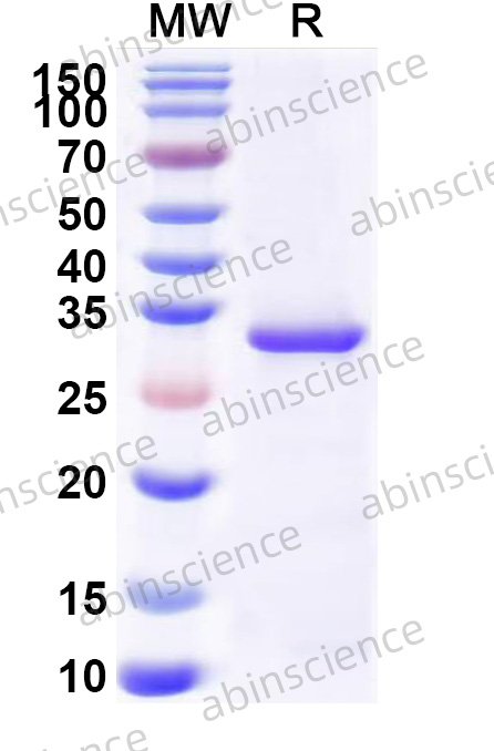 Escherichia phage lambda bet Recombinant Protein (N-His)