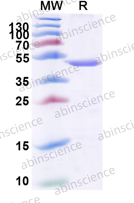 IBDV Capsid VP2 Recombinant Protein (N-His)