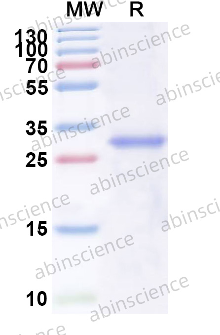 Monkeypox virus/MPXV A28 Recombinant Protein (N-His)
