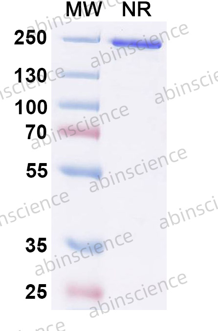 Anti-RAVV Envelope glycoprotein/GP Recombinant Antibody (SAA2752)
