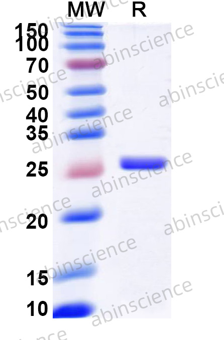 FMDV (SAT-1) VP2 Recombinant Protein (N-His)