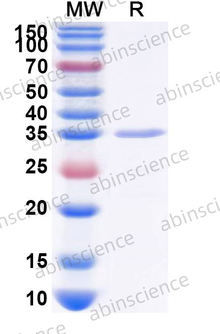 CVB3 VP1 Recombinant Protein (C-His)