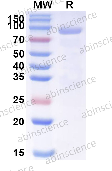 ANDV Gn Recombinant Protein (C-Fc)
